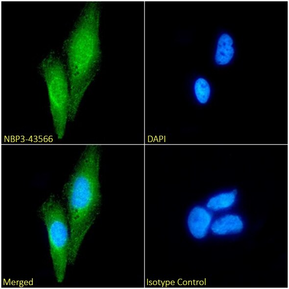 Cytokeratin 20 Antibody (10F6B12A9) - BSA Free Cytokeratin 20 Antibody (10F6B12A9) - BSA Free