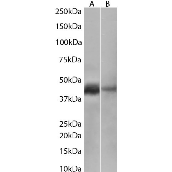 Cytokeratin 20 Antibody (10F6B12A9) - BSA Free Cytokeratin 20 Antibody (10F6B12A9) - BSA Free