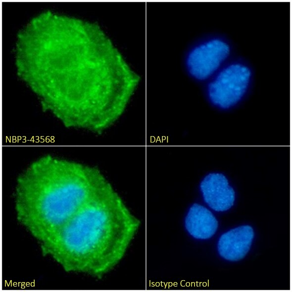 Cytokeratin 20 Antibody (10A2) - Chimeric - BSA Free Cytokeratin 20 Antibody (10A2) - Chimeric - BSA Free