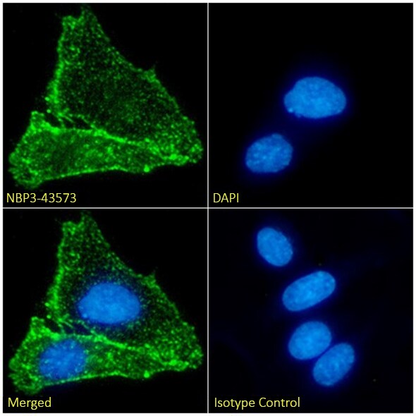 Nicotinic Acetylcholine Receptor beta 2 Antibody (12H2) - BSA Free Nicotinic Acetylcholine Receptor beta 2 Antibody (12H2) - BSA Free