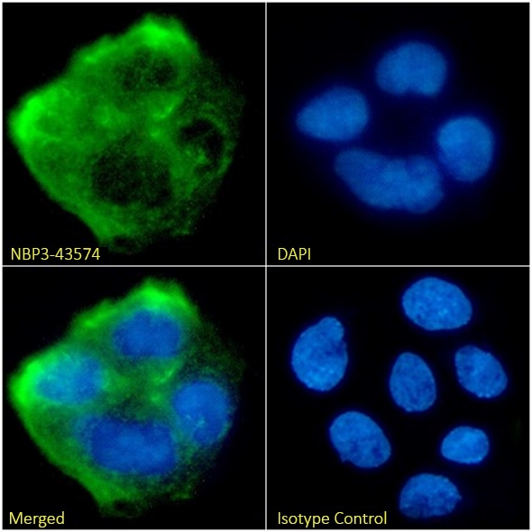 DOG1/TMEM16A Antibody (19F2) - Chimeric - BSA Free DOG1/TMEM16A Antibody (19F2) - Chimeric - BSA Free
