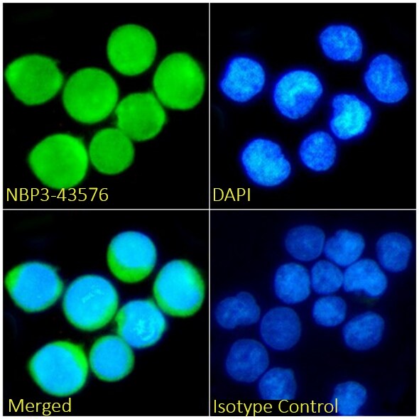 TdT Antibody (32D5) - Chimeric - BSA Free TdT Antibody (32D5) - Chimeric - BSA Free