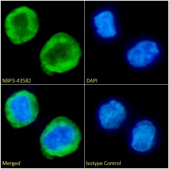 KRAS Antibody (D113) - Mutant - BSA Free KRAS Antibody (D113) - Mutant - BSA Free