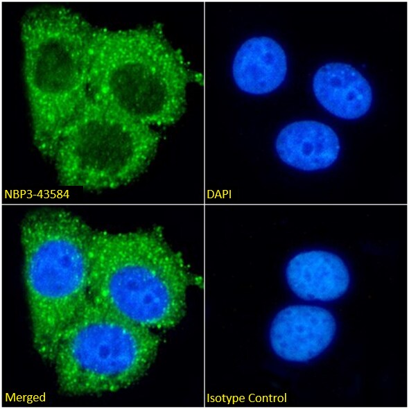Ferritin mitochondrial Antibody (F11 (HSF102)) - BSA Free