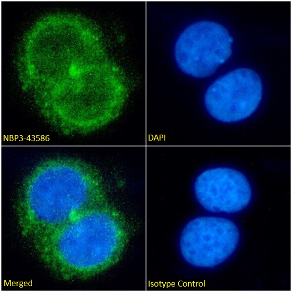 Ferritin mitochondrial Antibody (AMB8LK) - BSA Free