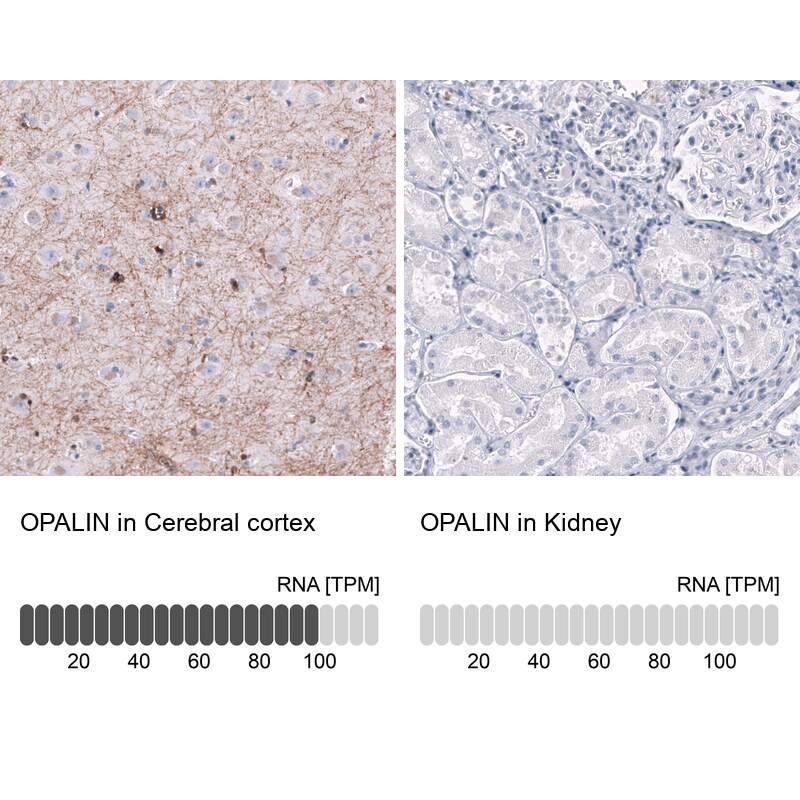 OPALIN Antibody (CL11142) [Unconjugated] Immunohistochemistry-Paraffin: OPALIN Antibody (CL11142) [NBP3-43641]