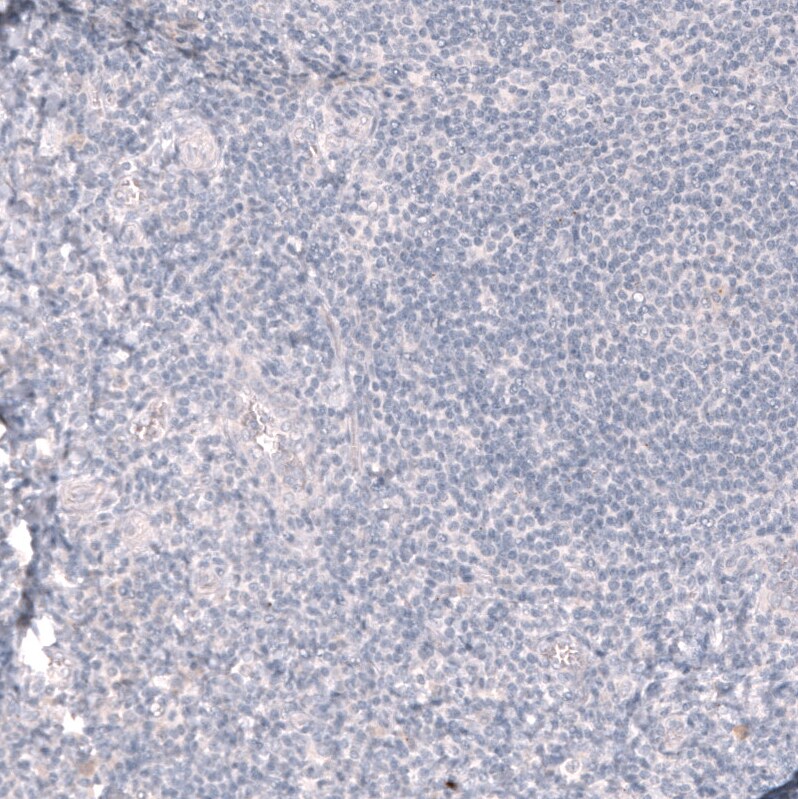 ABCB5 Antibody (CL13618) [Unconjugated] Immunohistochemistry-Paraffin: ABCB5 Antibody (CL13618) [NBP3-43642]