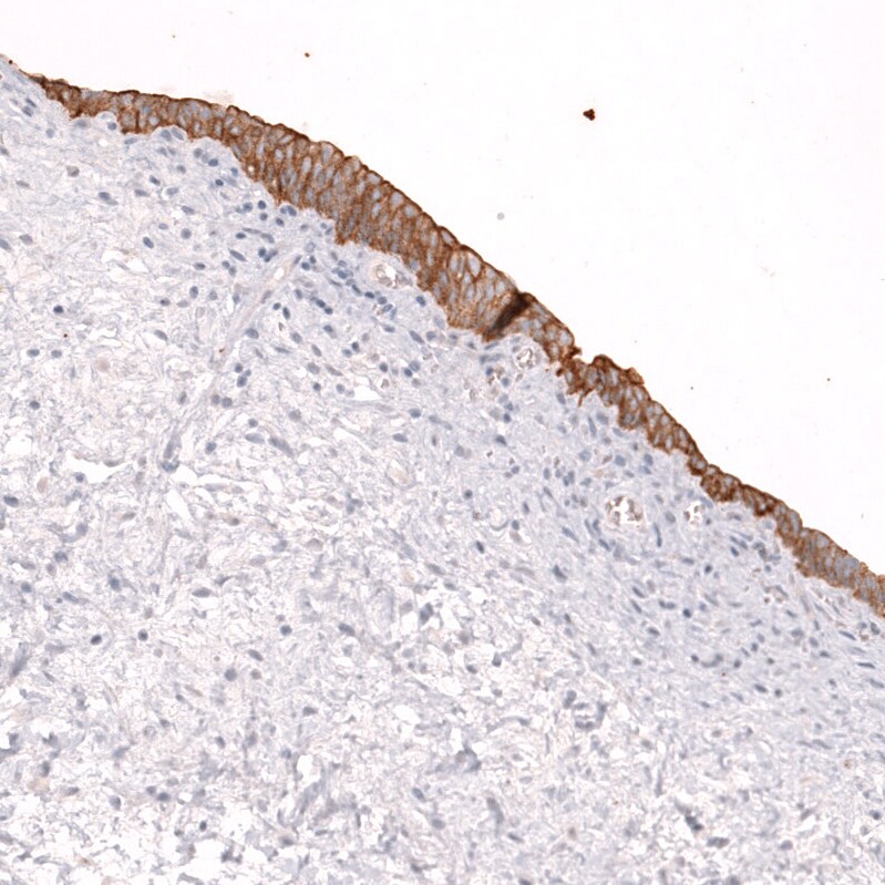 ABCB5 Antibody (CL13618) [Unconjugated] Immunohistochemistry-Paraffin: ABCB5 Antibody (CL13618) [NBP3-43642]