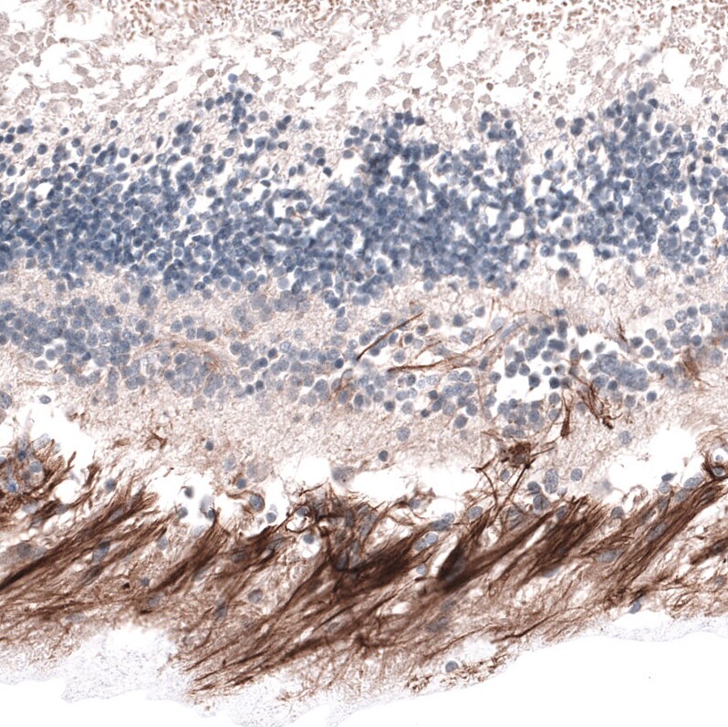 ABCB5 Antibody (CL13618) [Unconjugated] Immunohistochemistry-Paraffin: ABCB5 Antibody (CL13618) [NBP3-43642]