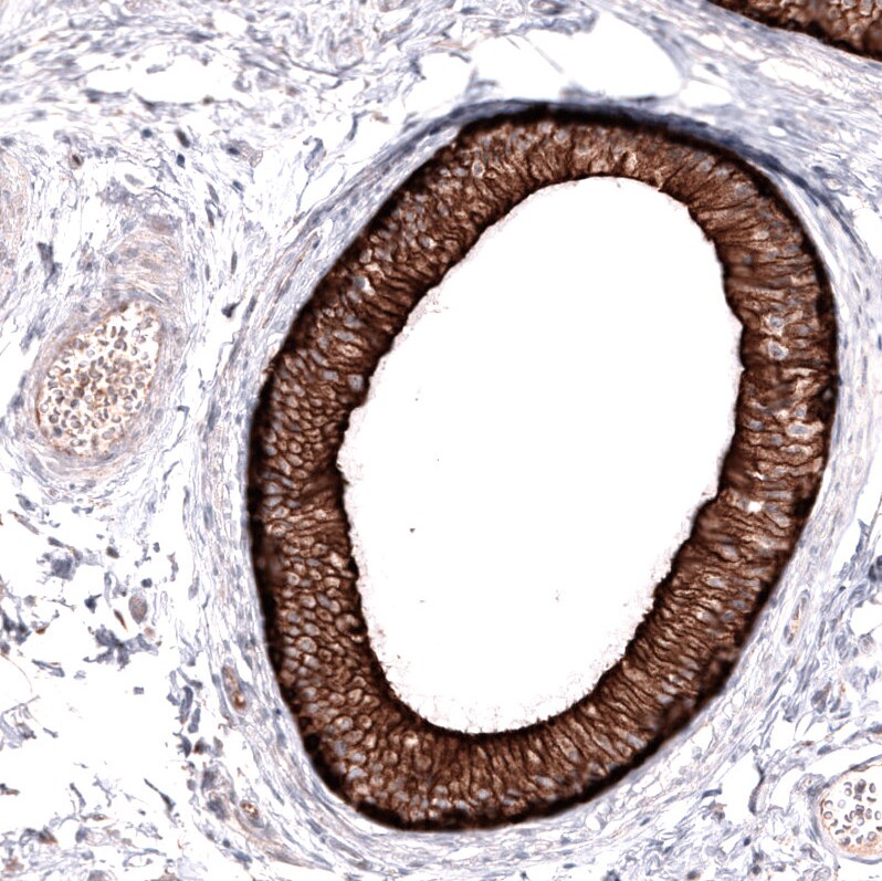 ABCB5 Antibody (CL13618) [Unconjugated] Immunohistochemistry-Paraffin: ABCB5 Antibody (CL13618) [NBP3-43642]