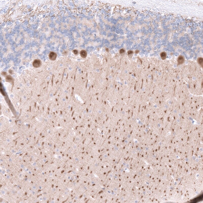 Calbindin D-28K Antibody (CL15060) [Unconjugated] Immunohistochemistry-Paraffin: Calbindin D-28K Antibody (CL15060) [NBP3-43645]