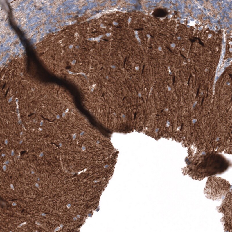 Calbindin D-28K Antibody (CL15060) [Unconjugated] Immunohistochemistry-Paraffin: Calbindin D-28K Antibody (CL15060) [NBP3-43645]