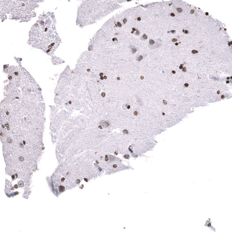 LHX9 Antibody (CL15043) [Unconjugated] Immunohistochemistry-Paraffin: LHX9 Antibody (CL15043) [NBP3-43646]