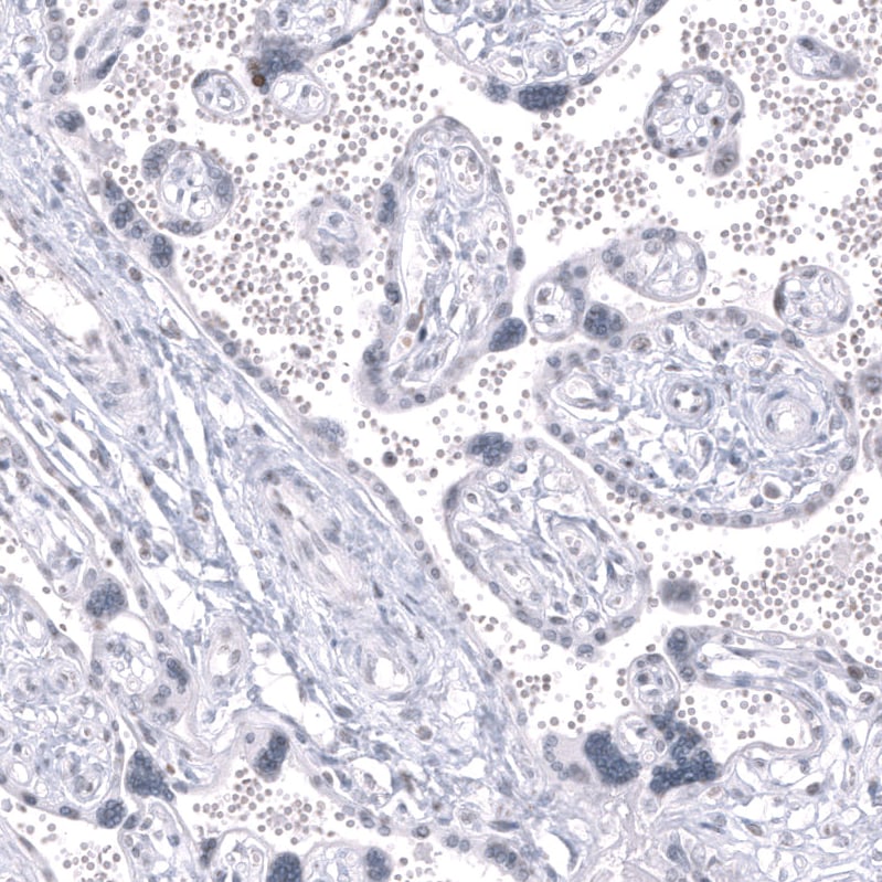 LHX9 Antibody (CL15043) [Unconjugated] Immunohistochemistry-Paraffin: LHX9 Antibody (CL15043) [NBP3-43646]