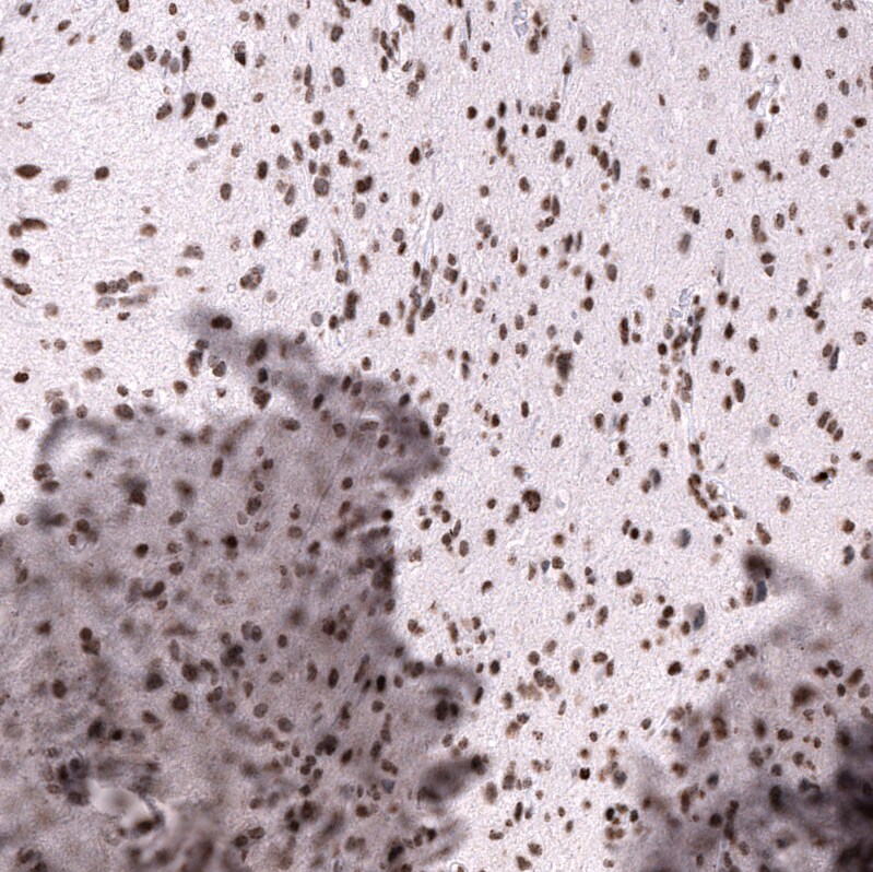 LHX9 Antibody (CL15043) [Unconjugated] Immunohistochemistry-Paraffin: LHX9 Antibody (CL15043) [NBP3-43646]