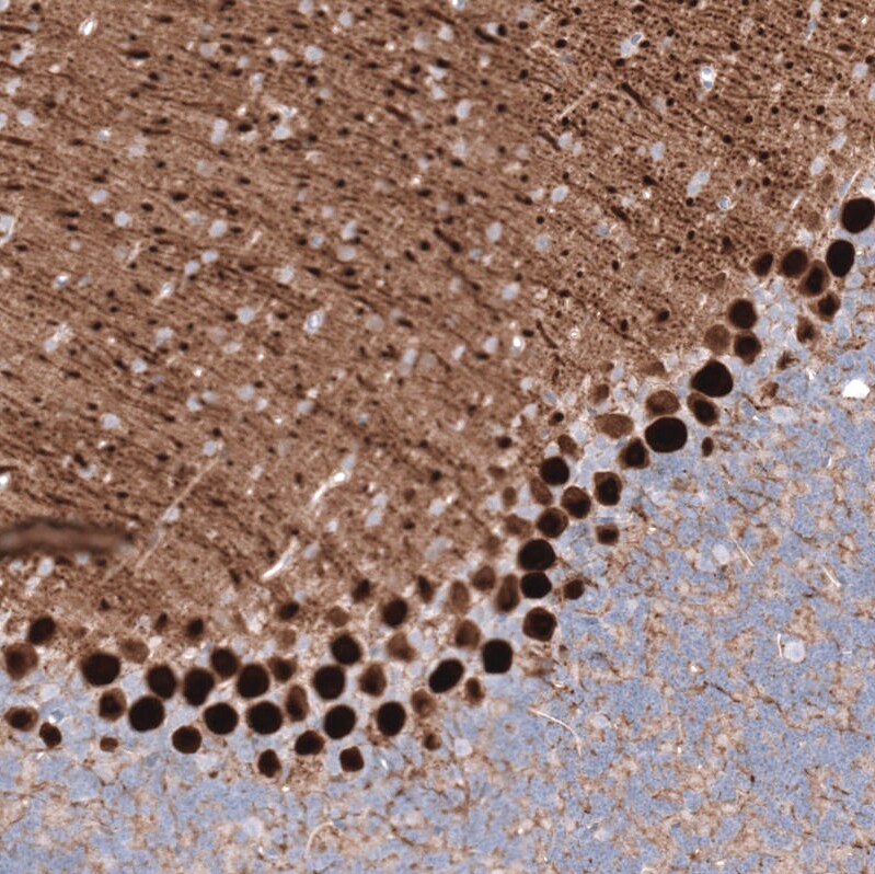 Calbindin D-28K Antibody (CL15059) [Unconjugated] Immunohistochemistry-Paraffin: Calbindin D-28K Antibody (CL15059) [NBP3-43647]