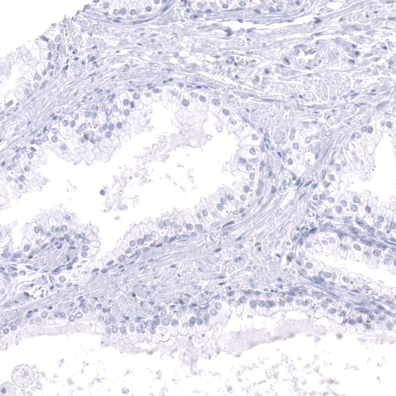Calbindin D-28K Antibody (CL15059) [Unconjugated] Immunohistochemistry-Paraffin: Calbindin D-28K Antibody (CL15059) [NBP3-43647]