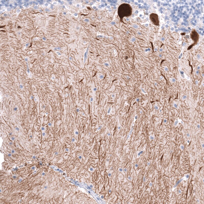 Calbindin D-28K Antibody (CL15059) [Unconjugated] Immunohistochemistry-Paraffin: Calbindin D-28K Antibody (CL15059) [NBP3-43647]