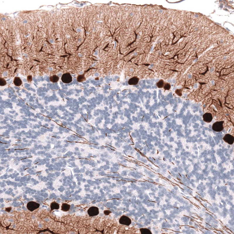 Calbindin D-28K Antibody (CL15059) [Unconjugated] Immunohistochemistry-Paraffin: Calbindin D-28K Antibody (CL15059) [NBP3-43647]