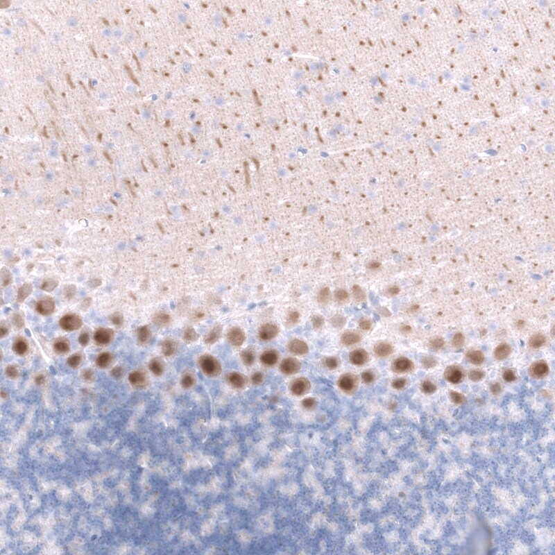 Calbindin D-28K Antibody (CL15065) [Unconjugated] Immunohistochemistry-Paraffin: Calbindin D-28K Antibody (CL15065) [NBP3-43648]