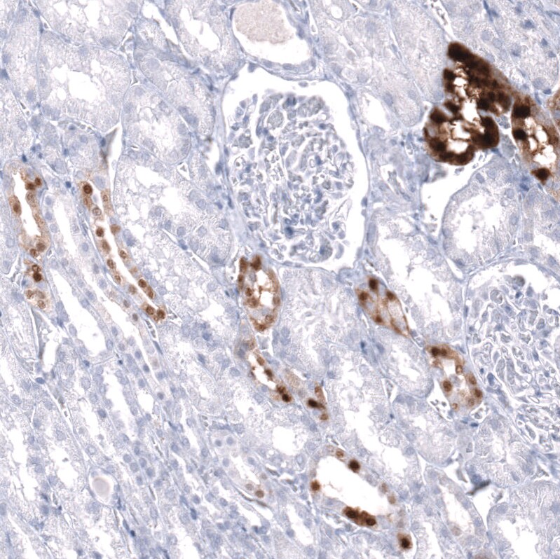 Calbindin D-28K Antibody (CL15065) [Unconjugated] Immunohistochemistry-Paraffin: Calbindin D-28K Antibody (CL15065) [NBP3-43648]