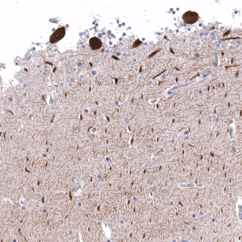 Calbindin D-28K Antibody (CL15065) [Unconjugated] Immunohistochemistry-Paraffin: Calbindin D-28K Antibody (CL15065) [NBP3-43648]