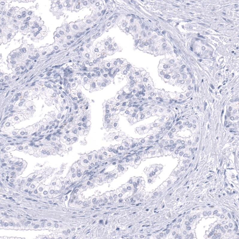 Calbindin D-28K Antibody (CL15065) [Unconjugated] Immunohistochemistry-Paraffin: Calbindin D-28K Antibody (CL15065) [NBP3-43648]