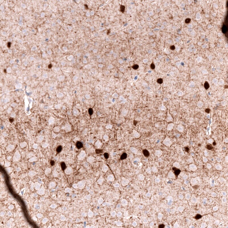 Parvalbumin Antibody (CL15070) [Unconjugated] Immunohistochemistry-Paraffin: Parvalbumin Antibody (CL15070) [NBP3-43649]