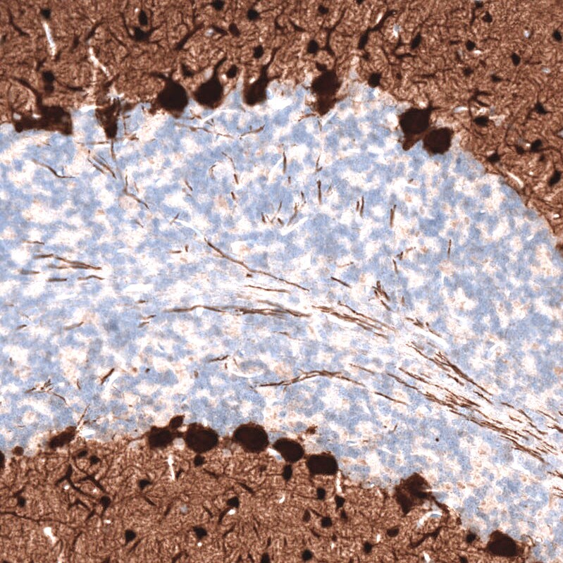 Parvalbumin Antibody (CL15070) [Unconjugated] Immunohistochemistry-Paraffin: Parvalbumin Antibody (CL15070) [NBP3-43649]