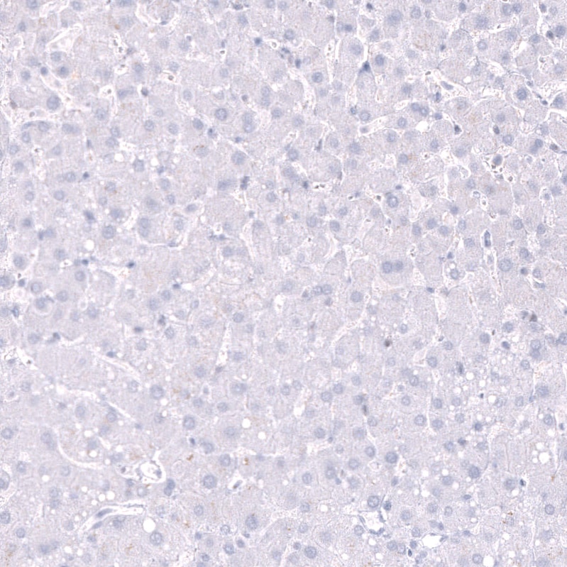 Parvalbumin Antibody (CL15070) [Unconjugated] Immunohistochemistry-Paraffin: Parvalbumin Antibody (CL15070) [NBP3-43649]