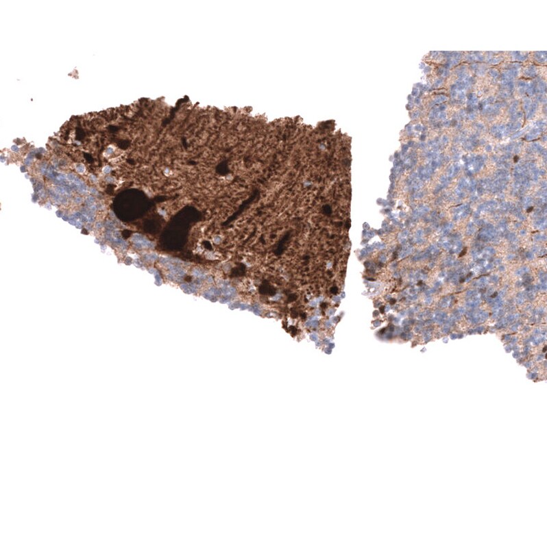Parvalbumin Antibody (CL15070) [Unconjugated] Immunohistochemistry-Paraffin: Parvalbumin Antibody (CL15070) [NBP3-43649]
