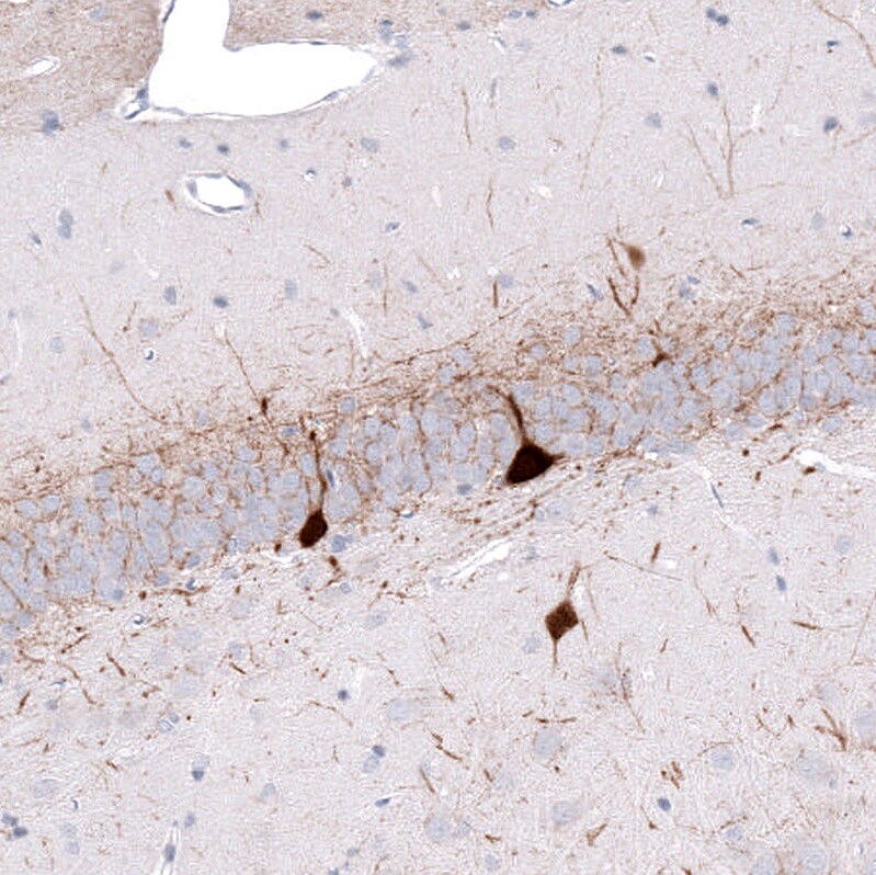 Parvalbumin Antibody (CL15070) [Unconjugated] Immunohistochemistry-Paraffin: Parvalbumin Antibody (CL15070) [NBP3-43649]
