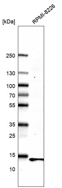 Parvalbumin Antibody (CL15072) [Unconjugated] Western blot: Parvalbumin Antibody (CL15072) [NBP3-43650]