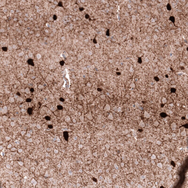 Parvalbumin Antibody (CL15072) [Unconjugated] Immunohistochemistry-Paraffin: Parvalbumin Antibody (CL15072) [NBP3-43650]