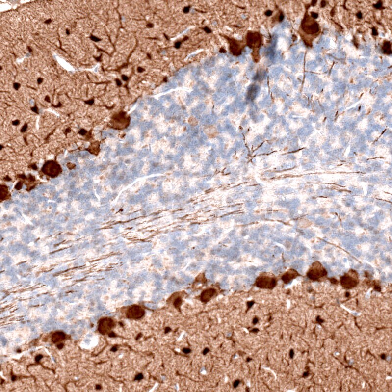 Parvalbumin Antibody (CL15072) [Unconjugated] Immunohistochemistry-Paraffin: Parvalbumin Antibody (CL15072) [NBP3-43650]