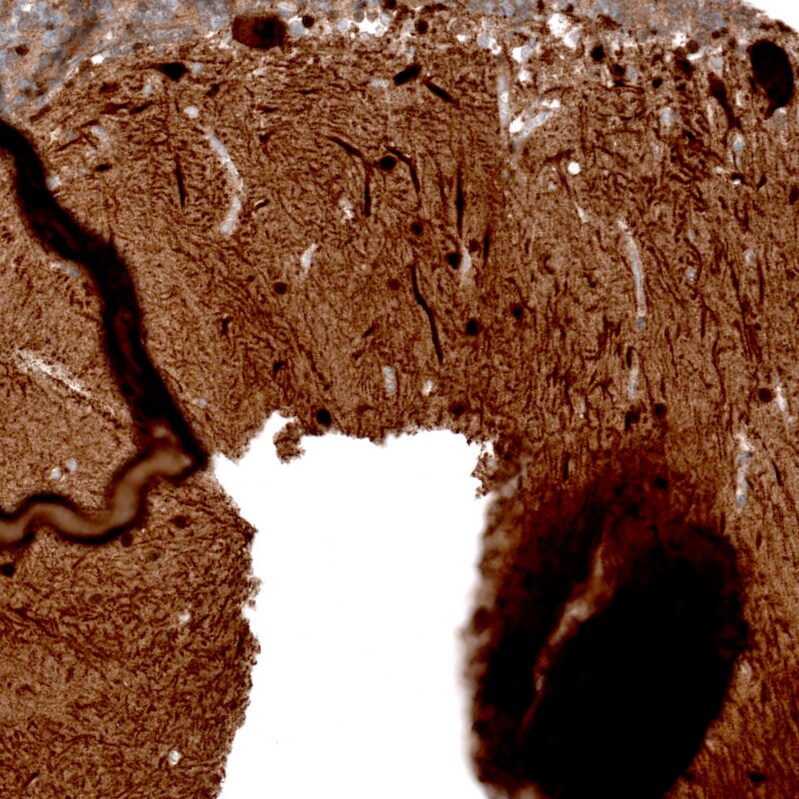 Parvalbumin Antibody (CL15073) [Unconjugated] Immunohistochemistry-Paraffin: Parvalbumin Antibody (CL15073) [NBP3-43651]