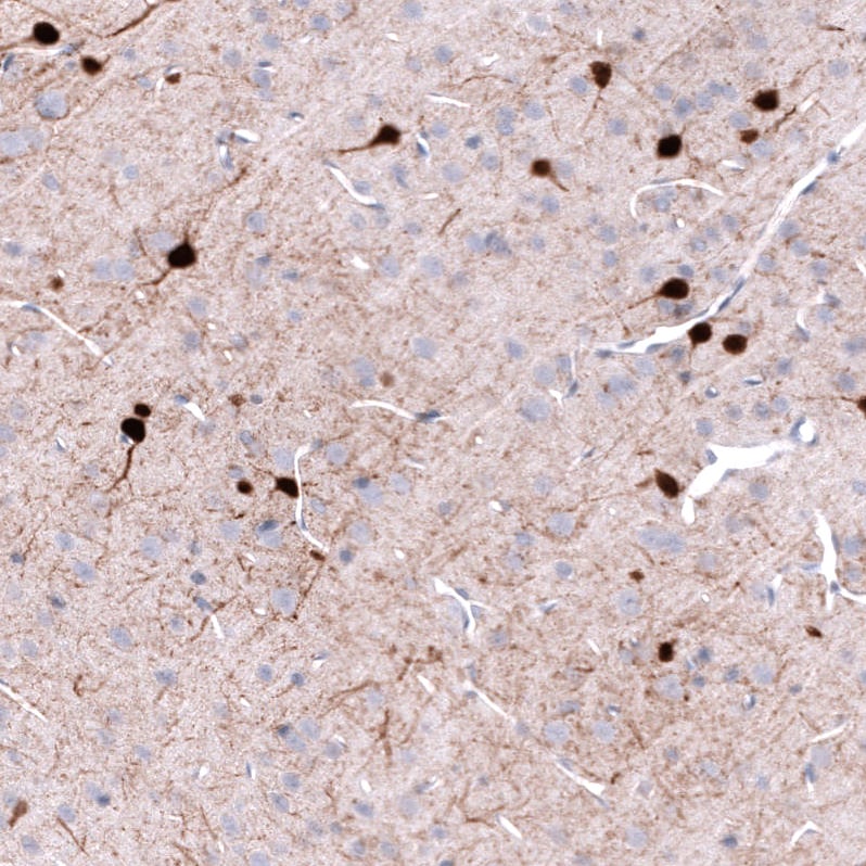 Parvalbumin Antibody (CL15073) [Unconjugated] Immunohistochemistry-Paraffin: Parvalbumin Antibody (CL15073) [NBP3-43651]