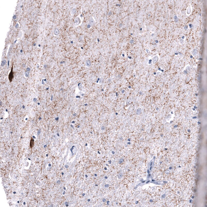 Somatostatin Antibody (CL15075) [Unconjugated] Immunohistochemistry-Paraffin: Somatostatin Antibody (CL15075) [NBP3-43652]