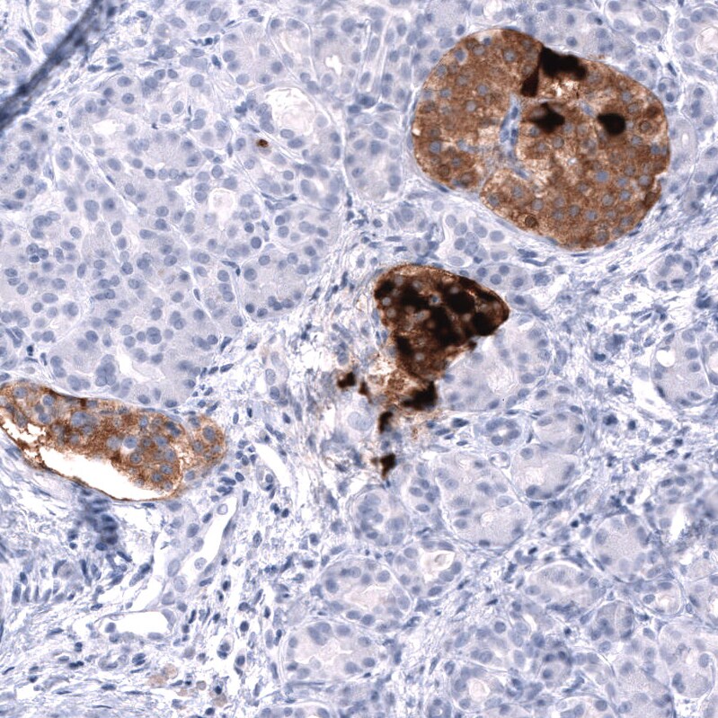 Somatostatin Antibody (CL15075) [Unconjugated] Immunohistochemistry-Paraffin: Somatostatin Antibody (CL15075) [NBP3-43652]