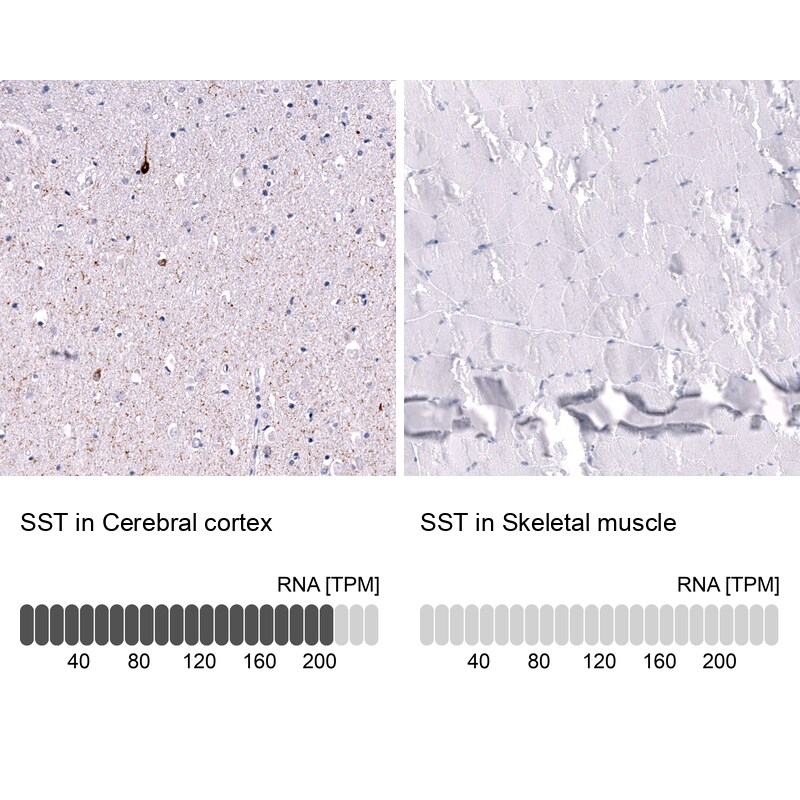 Somatostatin Antibody (CL15076) [Unconjugated] Immunohistochemistry-Paraffin: Somatostatin Antibody (CL15076) [NBP3-43653]
