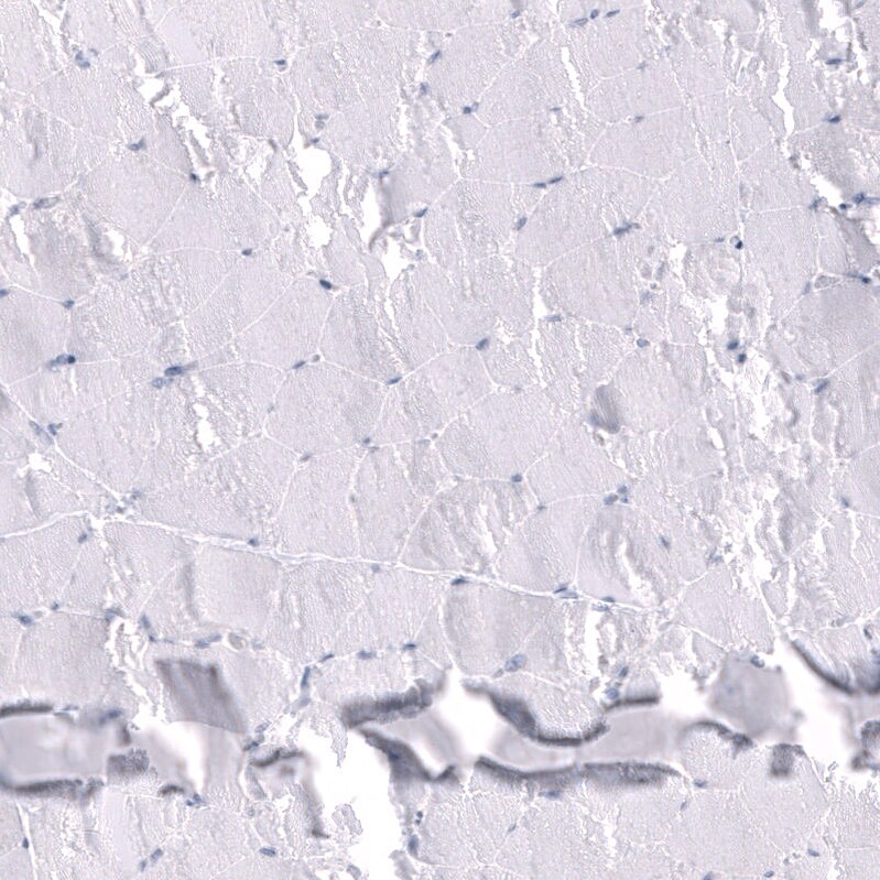 Somatostatin Antibody (CL15076) [Unconjugated] Immunohistochemistry-Paraffin: Somatostatin Antibody (CL15076) [NBP3-43653]