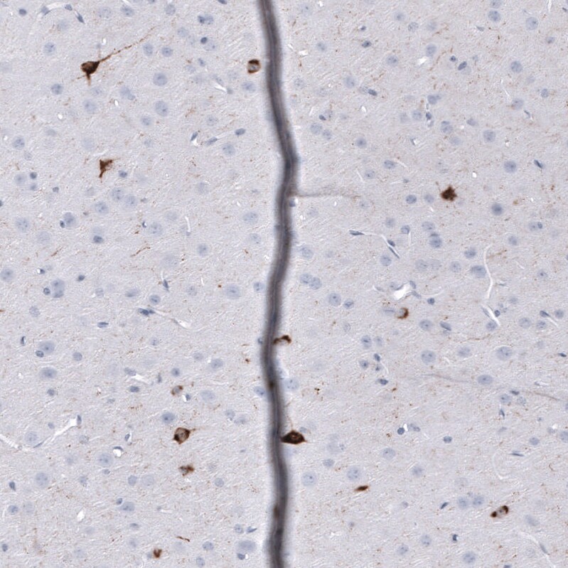 Somatostatin Antibody (CL15076) [Unconjugated] Immunohistochemistry-Paraffin: Somatostatin Antibody (CL15076) [NBP3-43653]