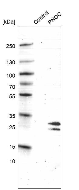 Nociceptin Antibody (CL15085) [Unconjugated] Western blot: Nociceptin Antibody (CL15085) [NBP3-43655]