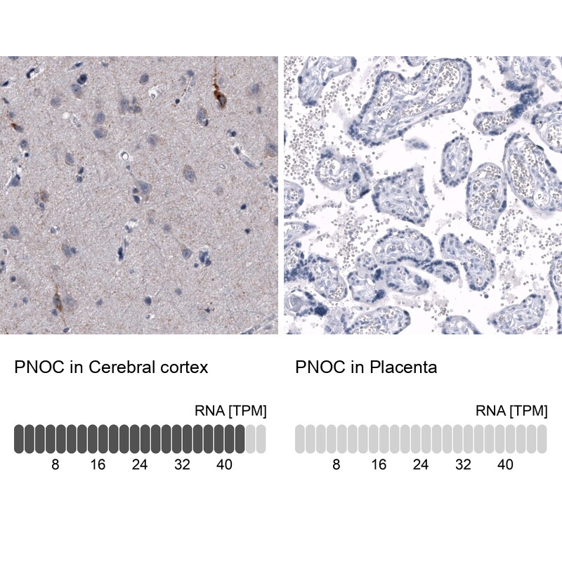 Nociceptin Antibody (CL15085) [Unconjugated] Immunohistochemistry-Paraffin: Nociceptin Antibody (CL15085) [NBP3-43655]