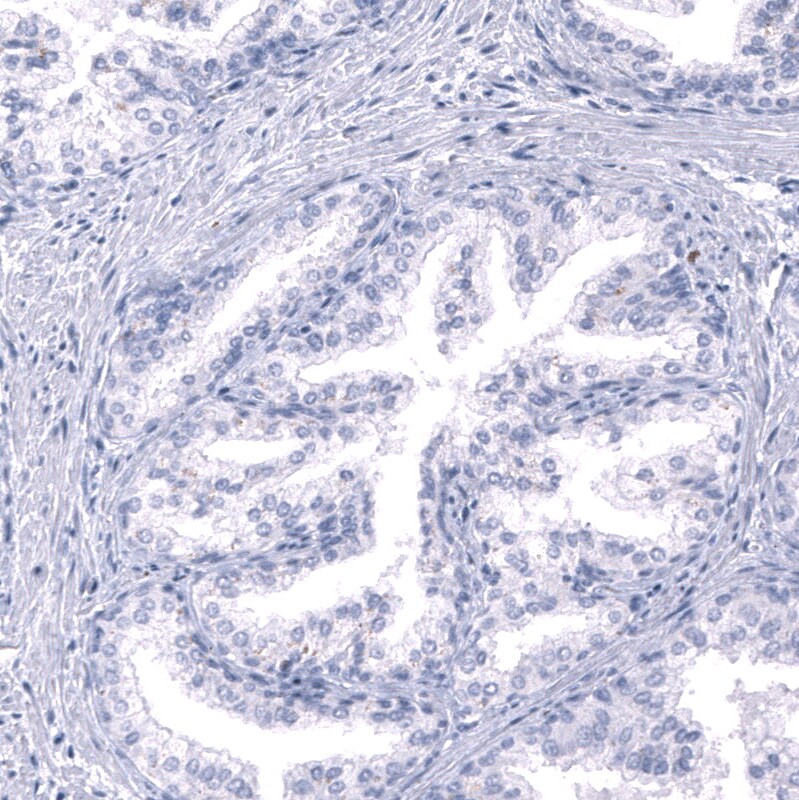 Nociceptin Antibody (CL15085) [Unconjugated] Immunohistochemistry-Paraffin: Nociceptin Antibody (CL15085) [NBP3-43655]