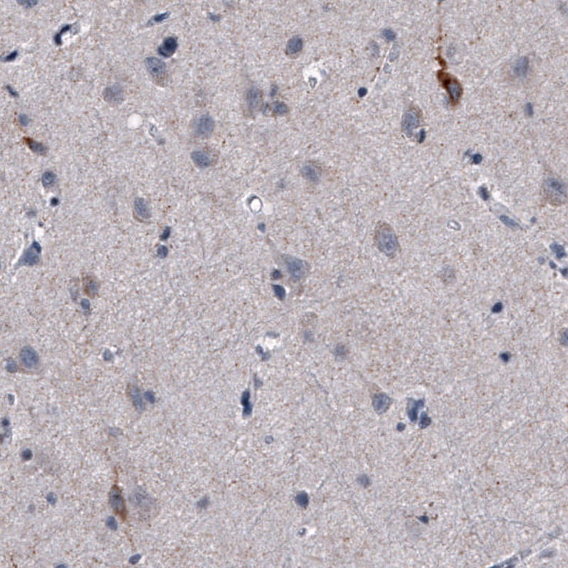 Nociceptin Antibody (CL15085) [Unconjugated] Immunohistochemistry-Paraffin: Nociceptin Antibody (CL15085) [NBP3-43655]