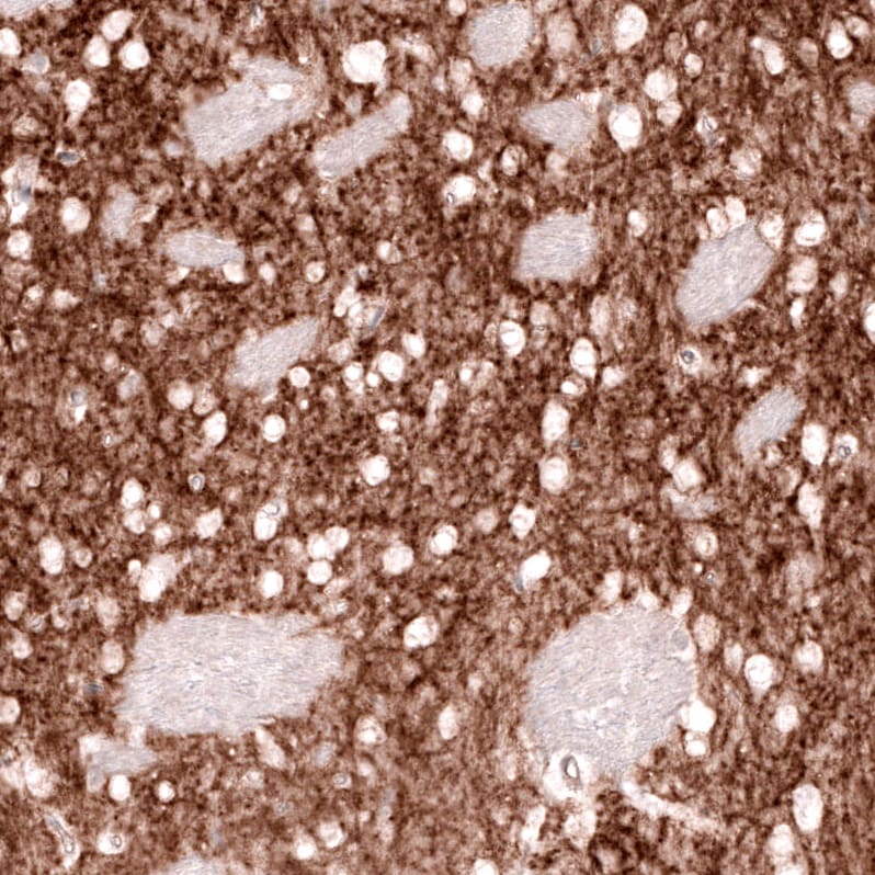 GPR88 Antibody (CL15190) [Unconjugated] Immunohistochemistry-Paraffin: GPR88 Antibody (CL15190) [NBP3-43656]
