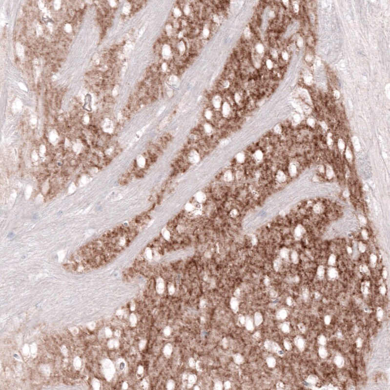 GPR88 Antibody (CL15190) [Unconjugated] Immunohistochemistry-Paraffin: GPR88 Antibody (CL15190) [NBP3-43656]