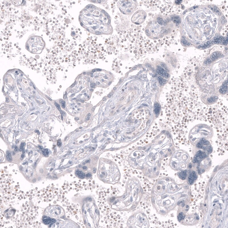 GPR88 Antibody (CL15190) [Unconjugated] Immunohistochemistry-Paraffin: GPR88 Antibody (CL15190) [NBP3-43656]