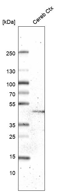 GPR88 Antibody (CL15190) [Unconjugated] Western blot: GPR88 Antibody (CL15190) [NBP3-43656]